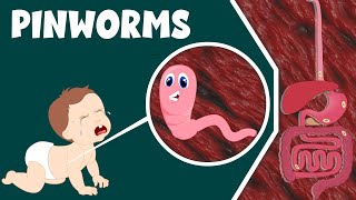 Pinworm Infection Causes and Treatment  Life Cycle of Pinworm  Video for Kids [upl. by Ambler798]