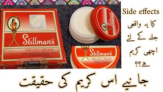 Stillmans freckle cream  Side effects  Honest Review on Stillmans freckle cream [upl. by Nilhtac]