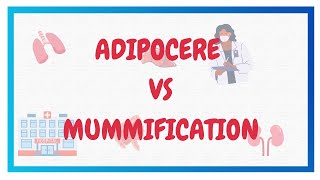 ADIPOCERE VS MUMMIFICATION  Postmortem changes  FMT  Hindi [upl. by Erej]