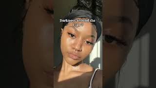 Remove Darkness Around Mouth Naturally🎀 beautifullady7 darklips [upl. by Ydnahs410]