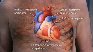 Macleods Physical Examination Of The Cardiovascular System OSCE Guide 2016 [upl. by Kimberli]