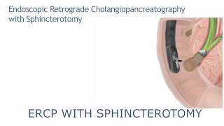 ERCP with sphincterotomy [upl. by Alfie]