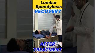 Lumbar Spondylosis Recovery After Treatment yt ytshorts ytviral doctor fitness fit 100 ad [upl. by Rehtse219]