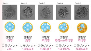体外受精７：胚のグレード [upl. by Ken958]