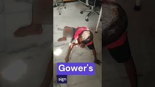 Gowers sign [upl. by Engud]