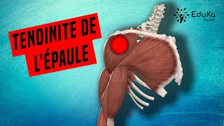 COMPRENDRE LA TENDINITE DE LÉPAULE Explications professionelles [upl. by Annayhs]