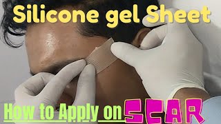 How to use silicone gel sheet for scar treatment How to apply silicone gel sheet on scar silicone [upl. by Eugenle372]