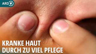 Kranke Haut durch zu viel Pflege Was bringen Peeling Gesichtsmaske und Pflegekur I ARD Gesund [upl. by Kela896]