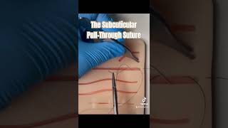 The Suture all adults and children love suture nursepractioner doctor sutures medicalschool [upl. by Ardnuasal]