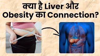 क्या है Liver और Obesity का कनेक्शन I Health Talk I OnlyMyHealth [upl. by Silden]