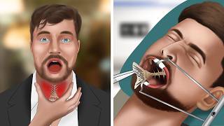 ASMR Animation Remove fish bones stuck in MrBeasts throat [upl. by Zara]