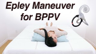 Epley Maneuver to Treat BPPV Dizziness with DixHallpike to Determine Which Side [upl. by Drhcir125]