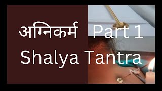 AGNIKARMA  part 1  Easy explanation  Shalya Tantra  BAMS ayurveda shalyatantra tuition easy [upl. by Normak]