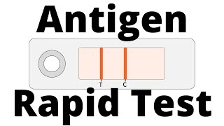 How SARSCoV2 Antigen Rapid Tests work Covid19 Testing [upl. by Orren]