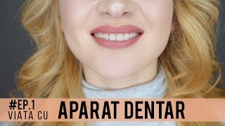 Viata cu aparat dentar fix  arcada superioara safir Ep1  Elena Nedelcu [upl. by Haig596]