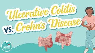 Ulcerative Colitis vs Crohns Disease  Know the Difference  Med Surg Help for Nursing School [upl. by Lark]