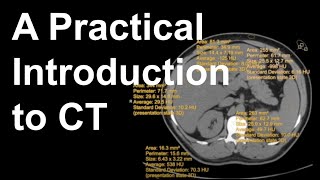 A Practical Introduction to CT [upl. by Oiracam]