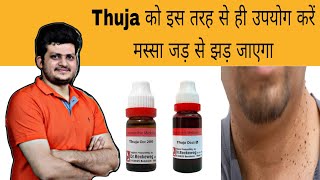 Thuja इस तरह से उपयोग करें मस्सा जड़ से झड़ जाएगा  Warts  Homeopathic Medicine  How to use [upl. by Aicaca792]