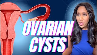 What Are Ovarian Cysts What Are the Symptoms How Are Ovarian Cysts Treated A Doctor Explains [upl. by Felicdad354]