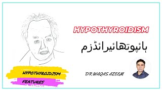 HYPOTHYROIDISM FEATURES [upl. by Aihsit]