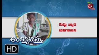 World Leprosy Day  Aarogyamastu  25th January 2019  ఆరోగ్యమస్తు [upl. by Placeeda160]