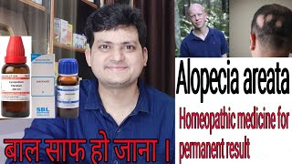 Homeopathic medicine for Alopecia areata  explain everything  permanent result [upl. by Maggs]