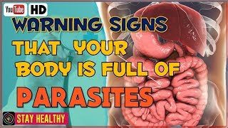 10 Warning Signs that Your Body is Full of Parasites [upl. by Hpeosj715]