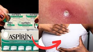 5 Surprising Uses Of Aspirin You Didnt Know [upl. by Shoshanna]