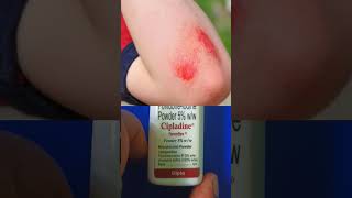 Cipladine Powder review  Povidone Iodine powder pharmatank5632 shorts viral shortvideo [upl. by Raynah573]