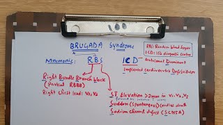 Brugada syndrome with mnemonic in less than 2 minutes [upl. by Cheryl]