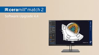 Ceramill Upgrade 4 4  Ceramill Match 2 [upl. by Doone]