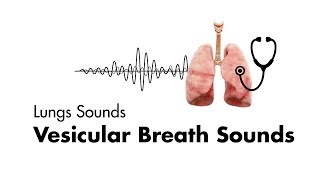 Vesicular Breath Sounds  Normal Lung Sounds  MEDZCOOL [upl. by Berlauda772]