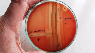 CAMP test for Streptococcus agalactiae  GBS [upl. by Anertak]