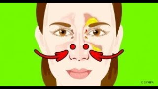 5 Façons efficaces de déboucher ton nez rapidement [upl. by Airtal118]