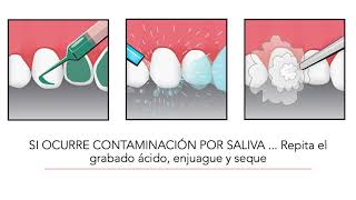 Bonding Video Espanol [upl. by Etolas]