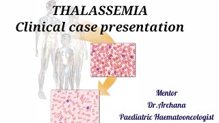 THALASSEMIA Clinical case presentation [upl. by Orly730]