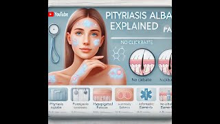 Pityriasis Alba PA [upl. by Ganiats131]