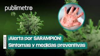 ¡Alerta por SARAMPIÓN Secretaría de Salud pide completar esquemas de vacunación [upl. by Else]