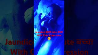 Jaundice 👉 Phototherapy Baby Cute Expression ll YouTube Shorts ll newbornbaby phototherapy [upl. by Mingche]