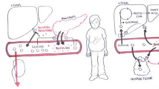 Diabetes Type II Pathophysiology [upl. by Eleazar]