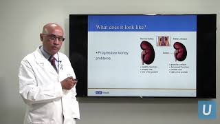 Kidney Disease What You Should Know  Anjay Rastogi MD  UCLAMDChat [upl. by Enelam]