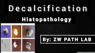 decalcification histopathology [upl. by Chitkara255]