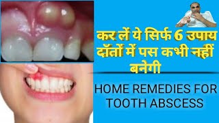 Top 6 home Remedies for Tooth Abscess  Home remedy for tooth Abscess  दॉतों के पस का घरेलू इलाज [upl. by Leopold982]