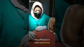 Episiotomy sciessor Part1 doctor delivery hospital nursingexperts pregnancy nursingstudents [upl. by Amsed]