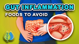 Top 5 Foods that Cause GUT Inflammation  AVOID  eat these anti inflammatory foods [upl. by Leiuqeze]