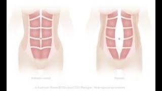 TRAINING ABDOMINAUX [upl. by Tollmann]