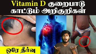 Vitamin D Why this vitamin is very important  what is vitamin D deficiency in Tamil  Vitamin D [upl. by Marcy]