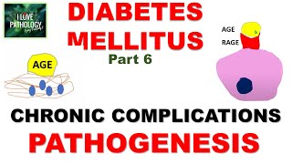 DIABETES MELLITUS  Part 6 Chronic Complications Pathogenesis [upl. by Attenahs]