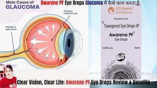 STOP Wasting Money on Ineffective Eye Drops Try AWARENEPF Instead [upl. by Magda744]