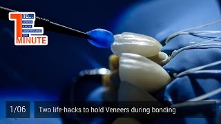 Two lifehacks to hold Veneers during bonding Episode 16 [upl. by Ineslta]